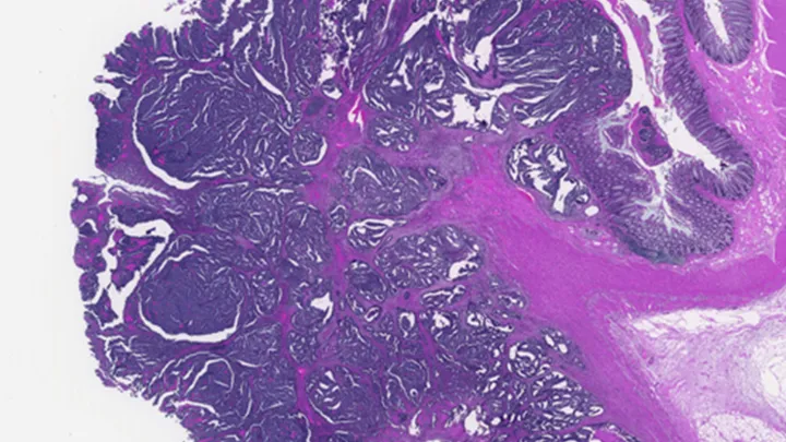 Stained gut tissue
