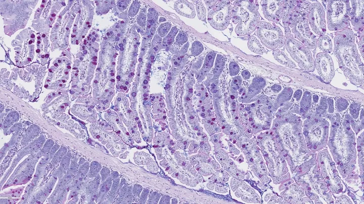 Gut_stained
