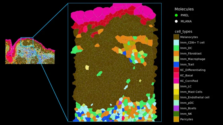 Revealing the cell type composition of melanoma at single cell resolution