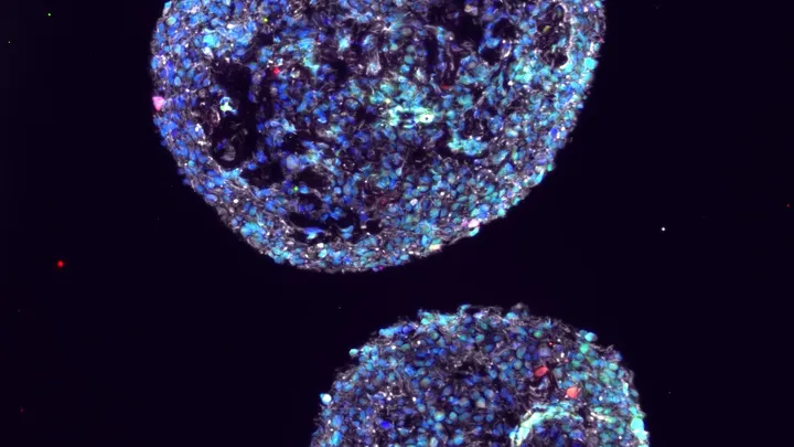 Cancer cells
