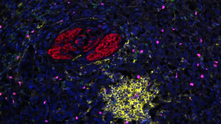 The Post Treatment Cancer Immunobiology Laboratory - web graphic