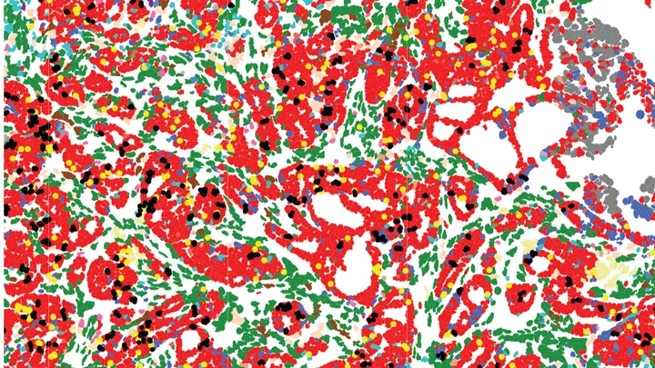 Powerful new tool reveals potential ‘goldmine’ of cancer targets hidden in ‘junk DNA’