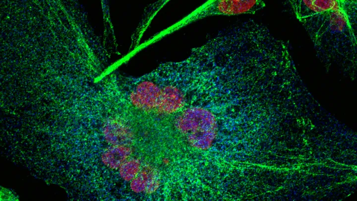 The Oncogenomics laboratory  - melanoma graphic
