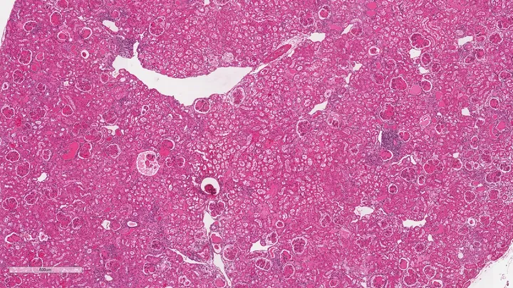 Kidney tissue
