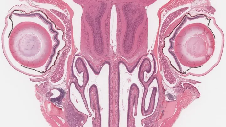 QIMR Berghofer Histology Facility - tissue sample