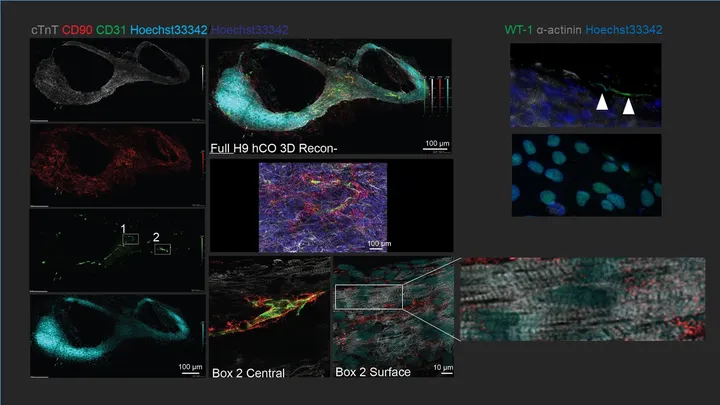 Organoid cell types