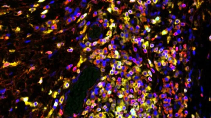 Stained cells