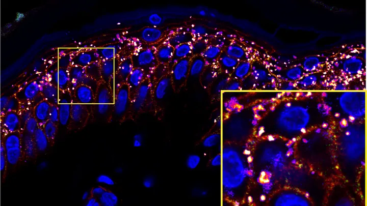 Probing the cell-cell communication through ligand-receptor interaction