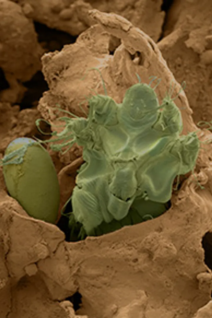 A scabies mite