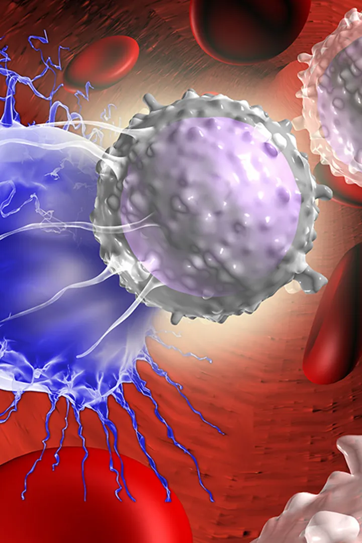 Brain cancer graphic