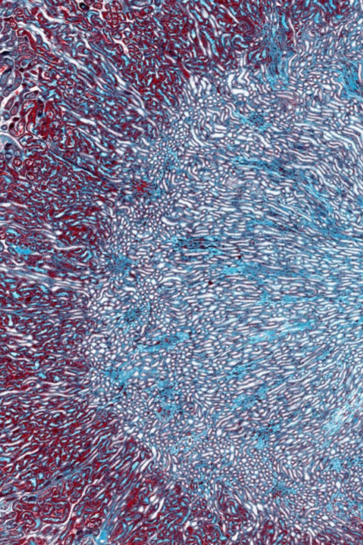 Colorectal cancer cells