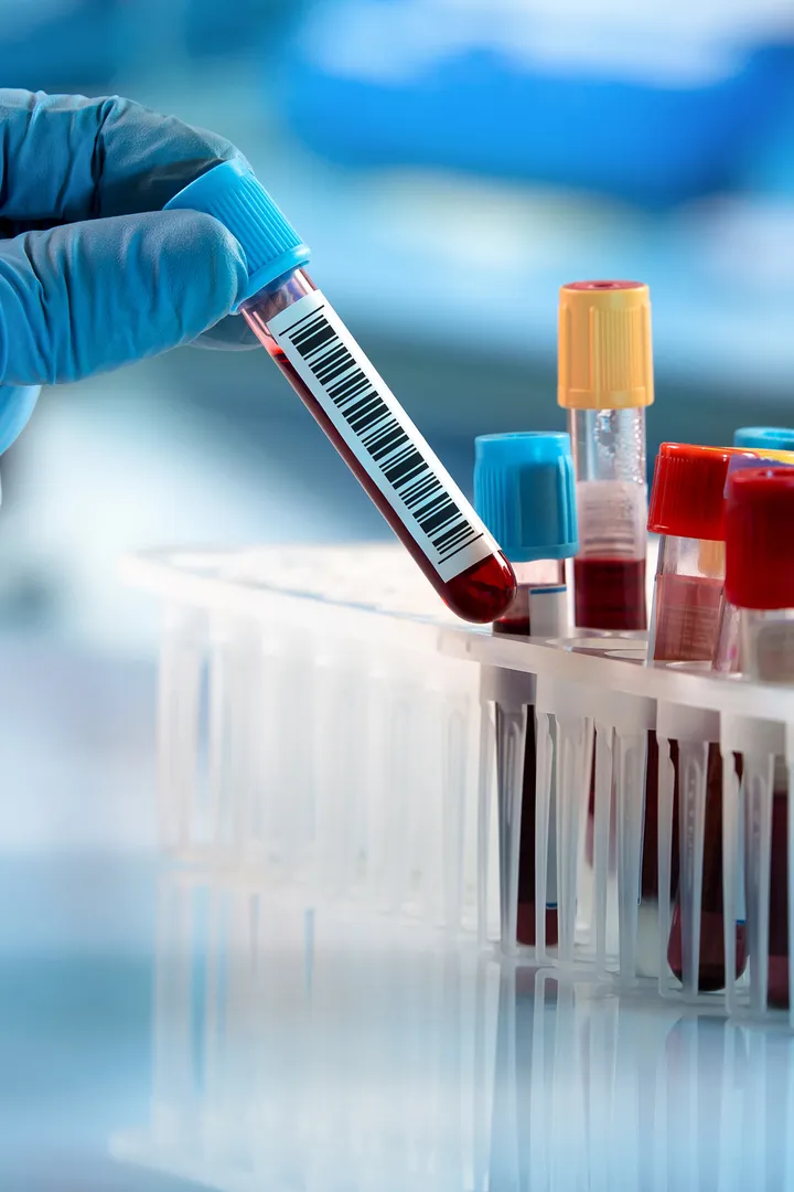 Blood samples
