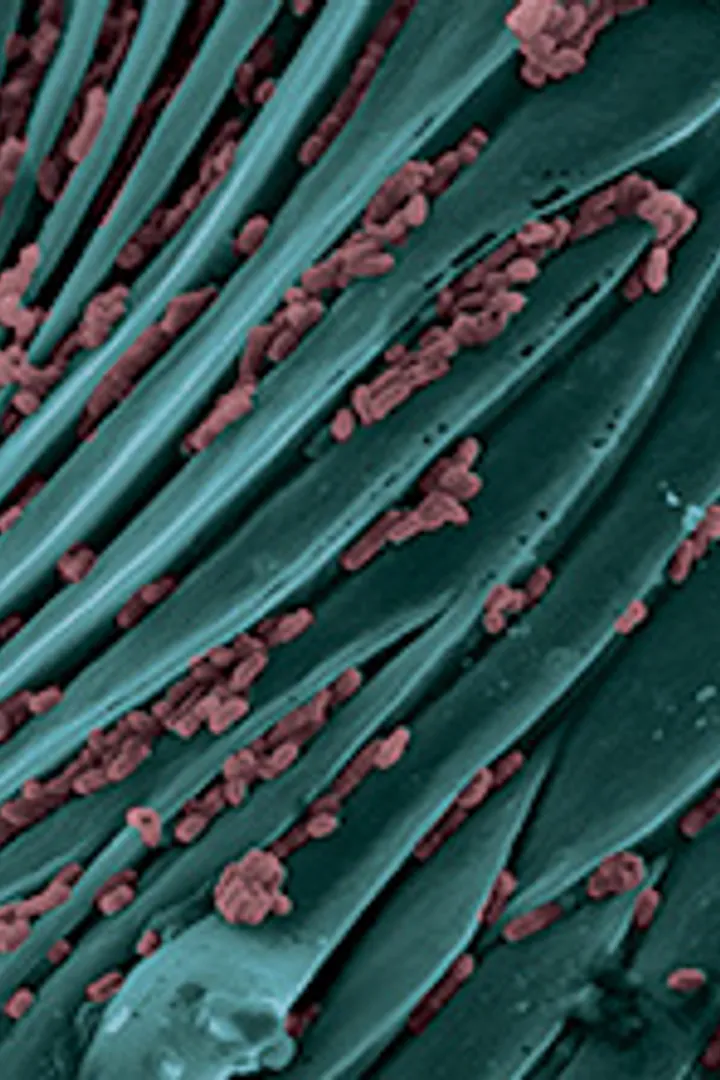 A close up of a scabies mite