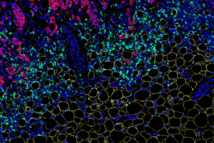 The Cancer Metabolism Group - web graphic