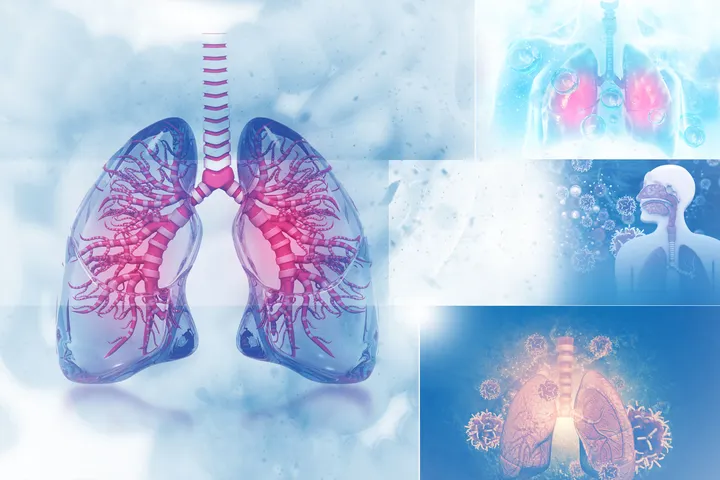 Asthma and Other Lung Diseases - graphic