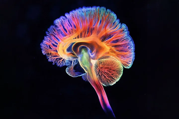 An image of the brain's network