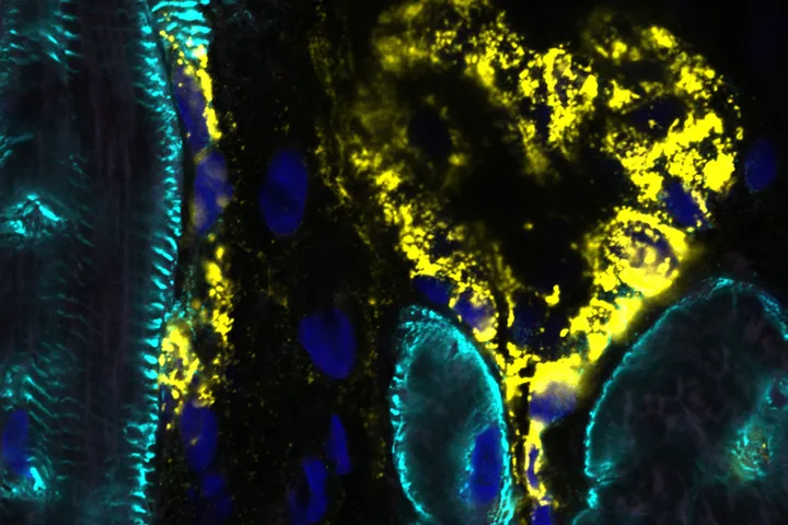 Cardiac Bioengineering QIMR raphic
