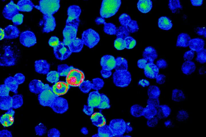 Epstein-Barr virus ells