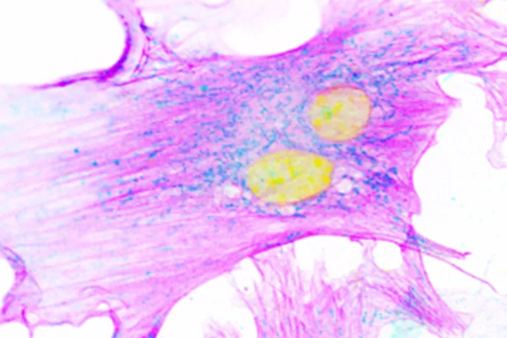 Hepatic fibrosis and cirrhosis research - web graphic