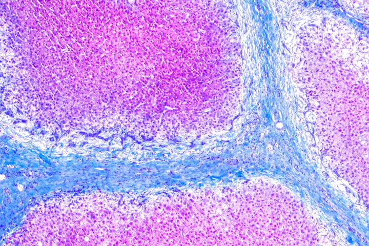 The Hepatic Fibrosis Laboratory