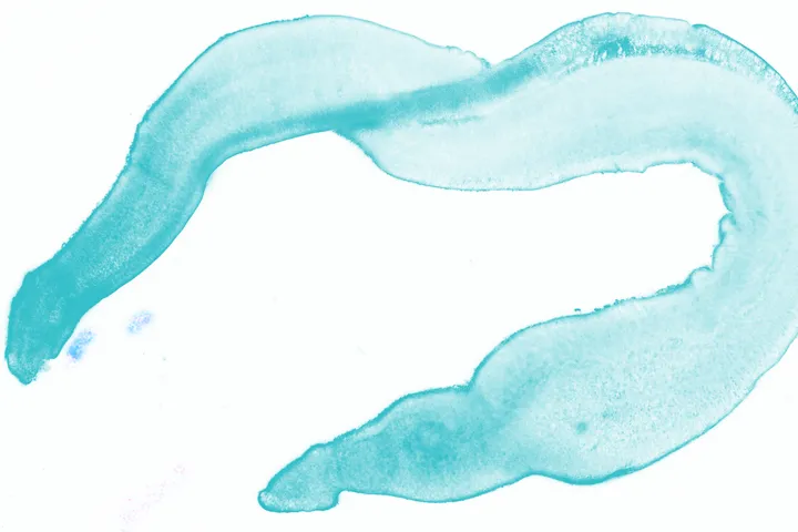 Intestinal worms - web graphic