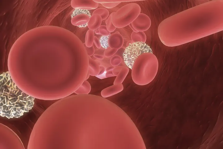 Iron Deficiency graphic