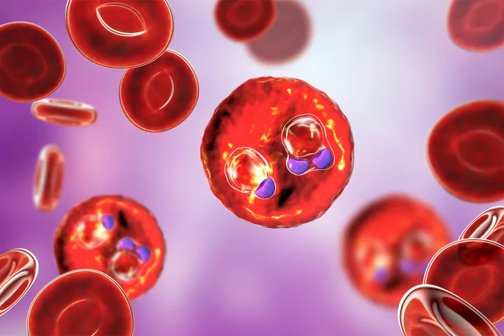 Malaria - infected blood cells