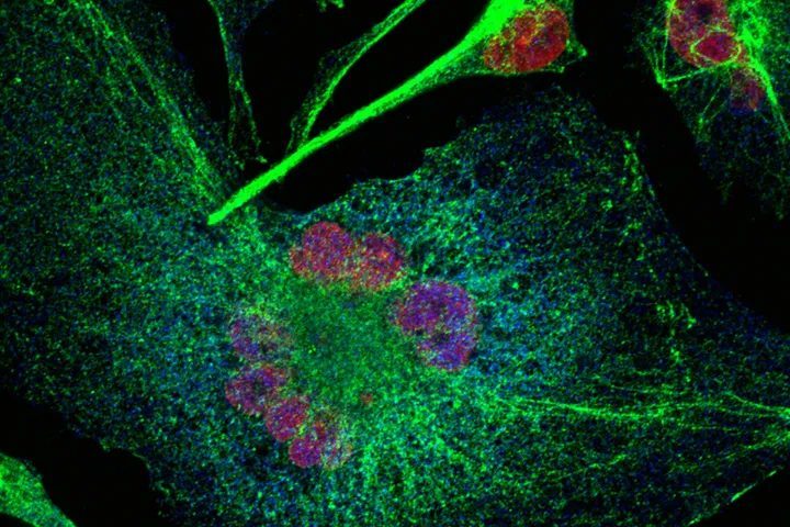 The Oncogenomics laboratory  - melanoma graphic
