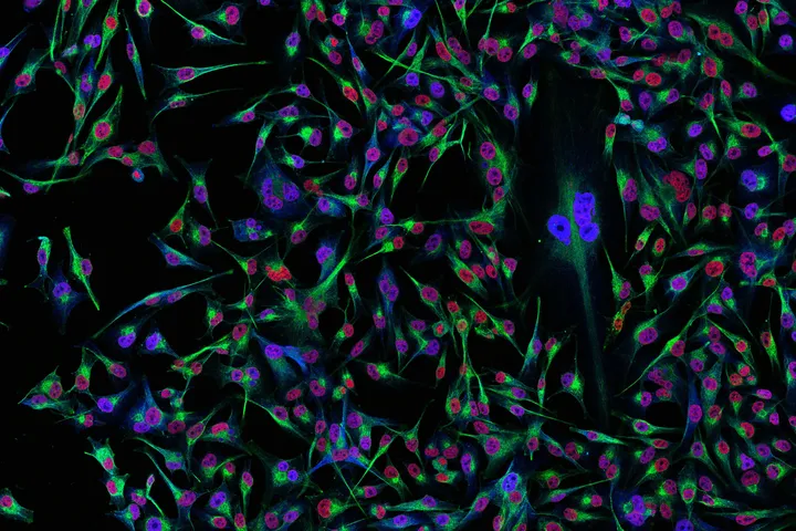 Melanoma cells