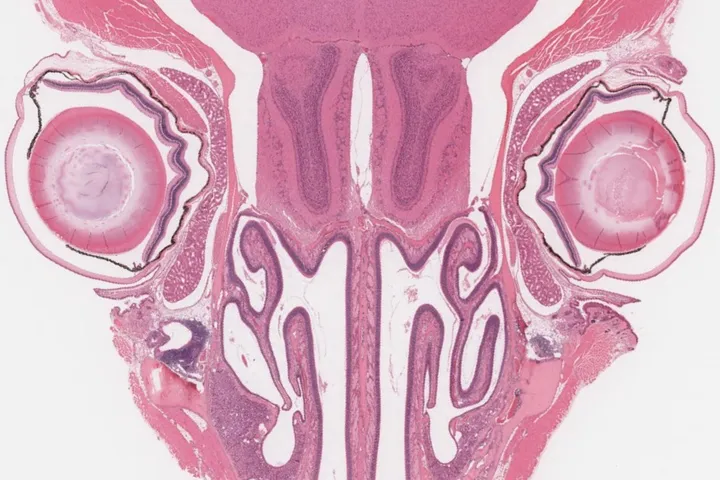 QIMR Berghofer Histology Facility - tissue sample