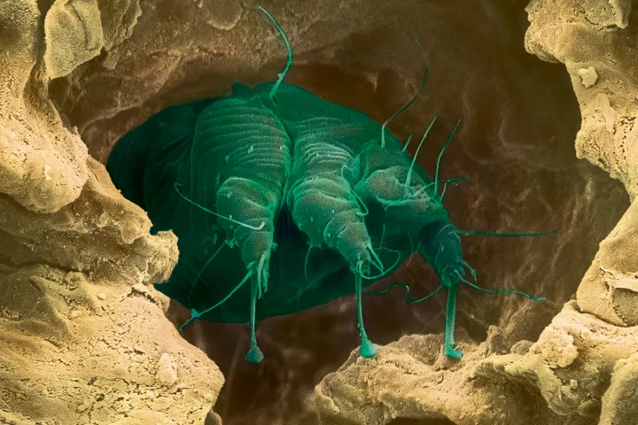 A scabies mite