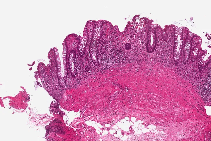 Gut Health Lab (gut tissue)