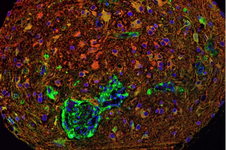 Sid Faithfull Brain Cancer Laboratory - web graphic
