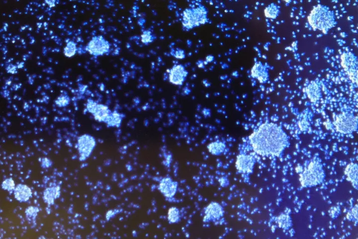 The Translational Cancer Immunotherapy Laboratory - web graphic