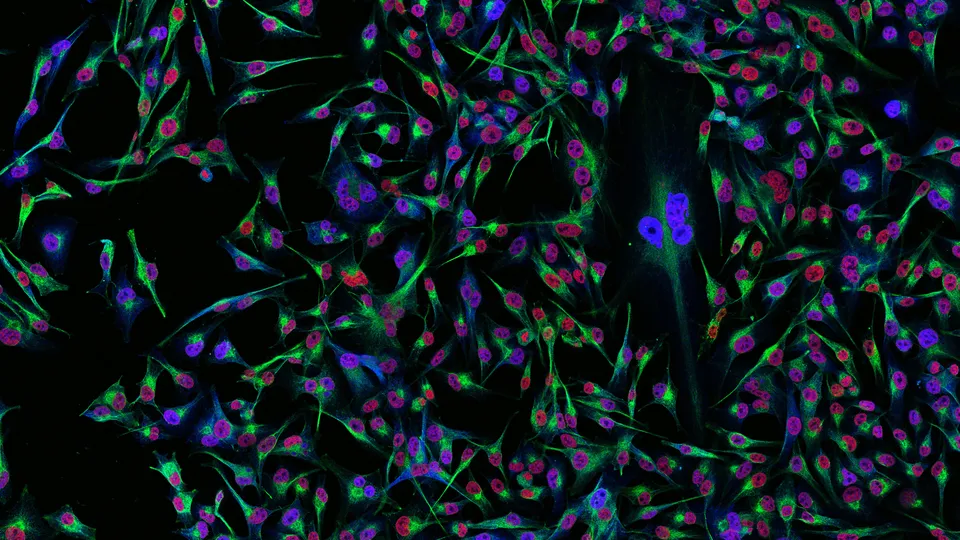QIMR Berghofer researchers lead landmark clinical trial on how Australians can better protect themselves from skin cancer