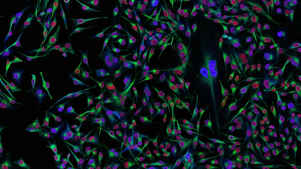 Melanoma cells