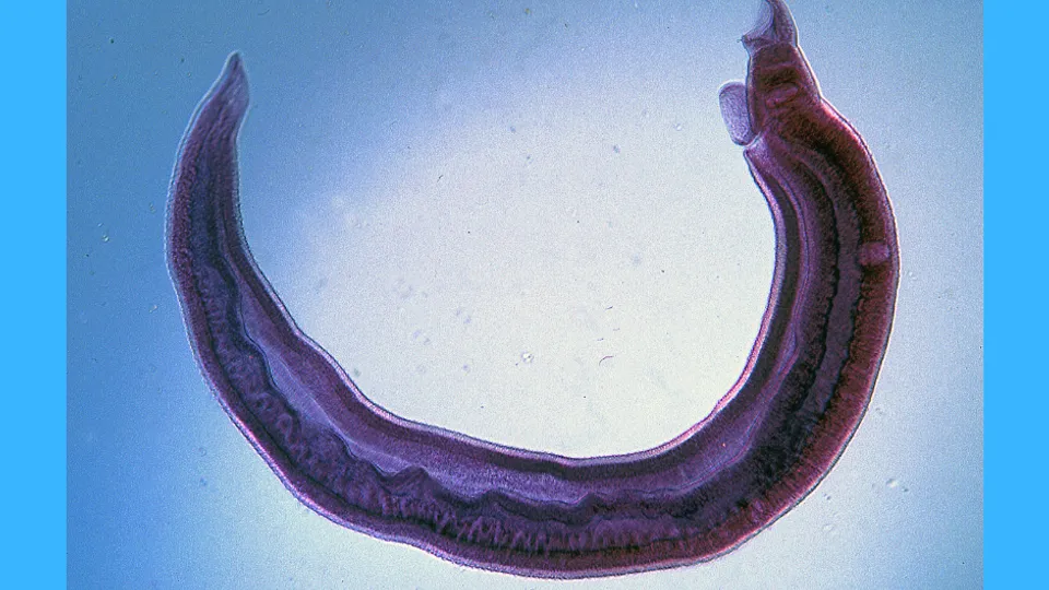 Who knew that toilet's could save lives?