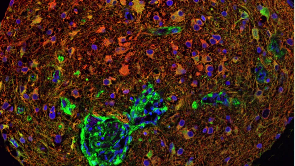 Sid Faithfull Brain Cancer Laboratory - web graphic