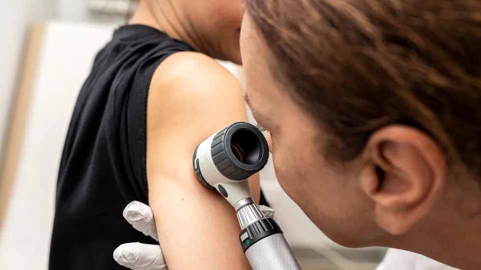 Know your own risk: Next-gen melanoma risk prediction calculator to help Australians act against deadly skin cancer