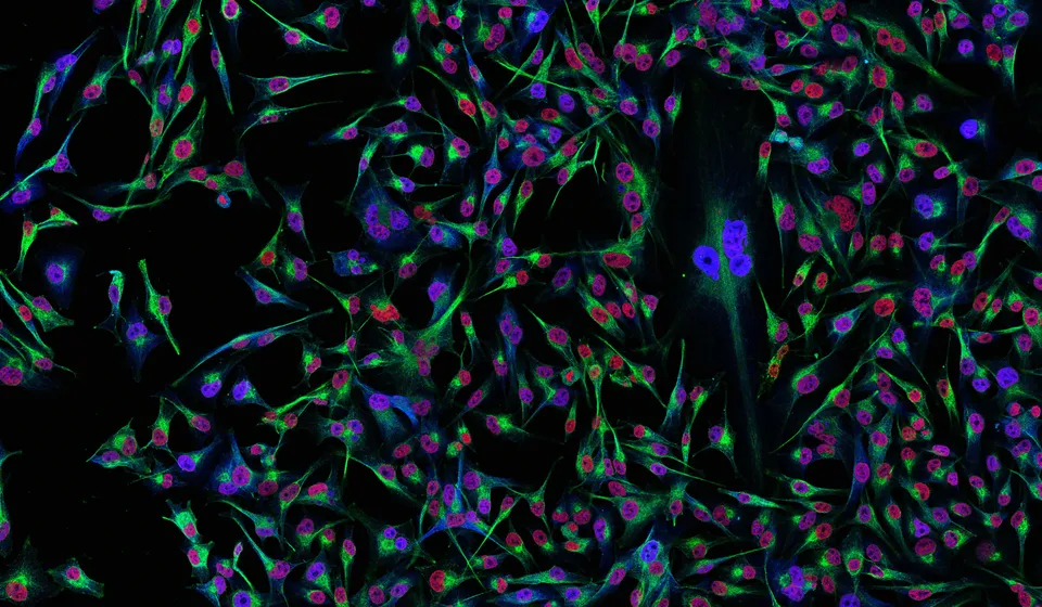 Melanoma cells